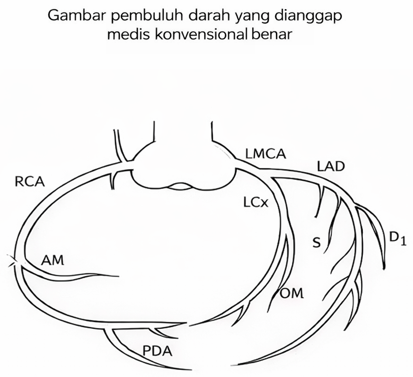 Ilustrasi pembuluh darah jantung